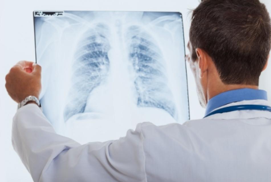Pulmonary Radiology
